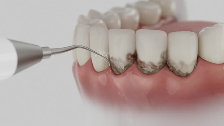 Trusted Root Canal Treatment service in Northville, MI - Dentist Open Now